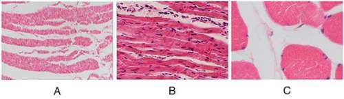 Where would muscle a in the image set most likely be found?  lining of a tendon lining o