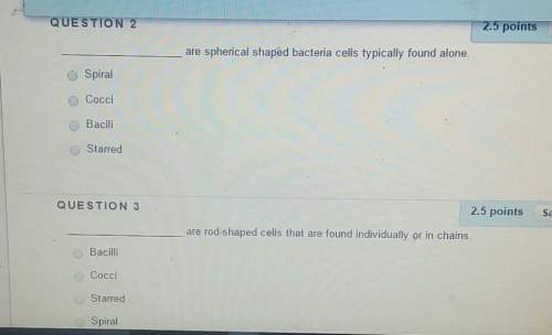 Poiare spherical shapèd bacteria cells typically found alone.spiralcoccibaci