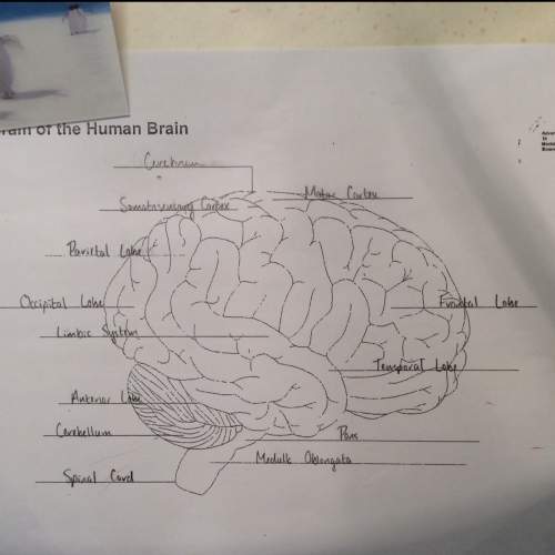 Can someone check if these are the correct parts of the brain? i am most unsure about the spots whe
