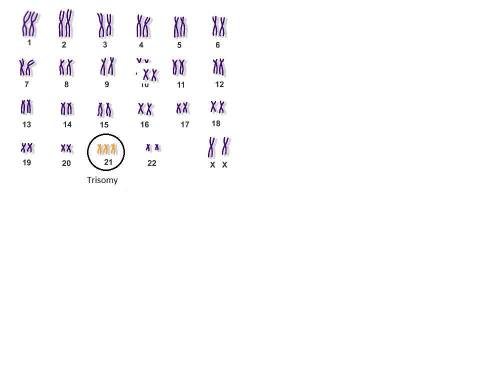 Karyotypes can be studied to determine an organism’s chromosomal makeup and to detect genetic defect