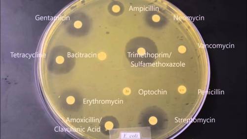 In the kirby-bauer antimicrobial susceptibility test, which of the following labels would indicate t