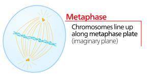 Which image in the onion root tip is an example of metaphase