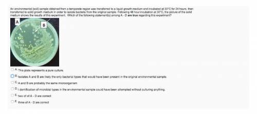 An environmental (soil) sample obtained from a temperate region was transferred to a liquid growth m