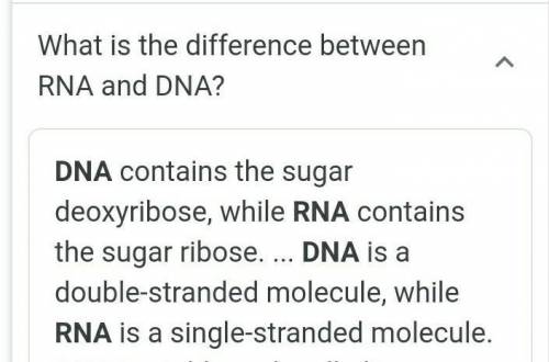 RNA is different from DNA because......