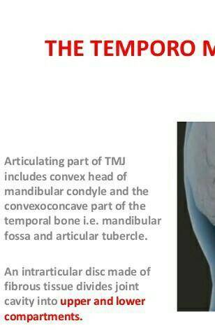 Name the mandibular motion resulting from the following combinations of muscle contractions: 

a) B