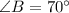 \angle B = 70^\circ