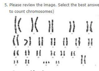 1the diagram shows the normal sequence of genes in a particular chromosome which chromosome could ha