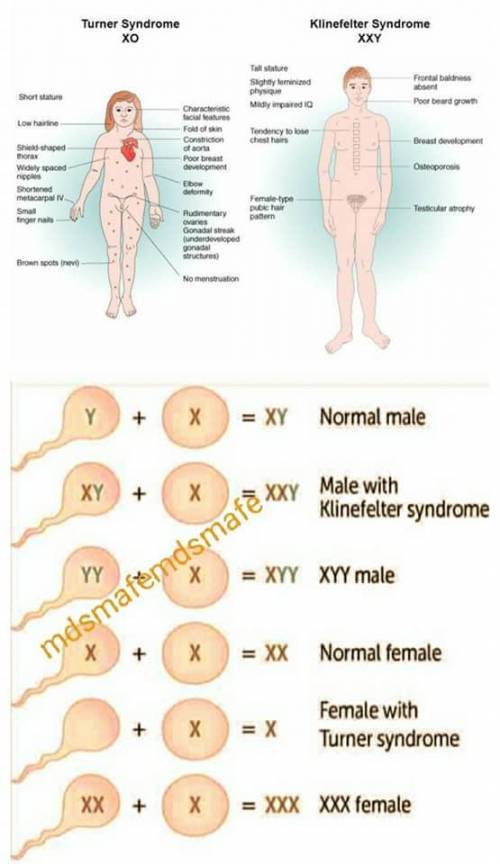 Someone who is  has a combination of what we think of as male and female reproductive systems or