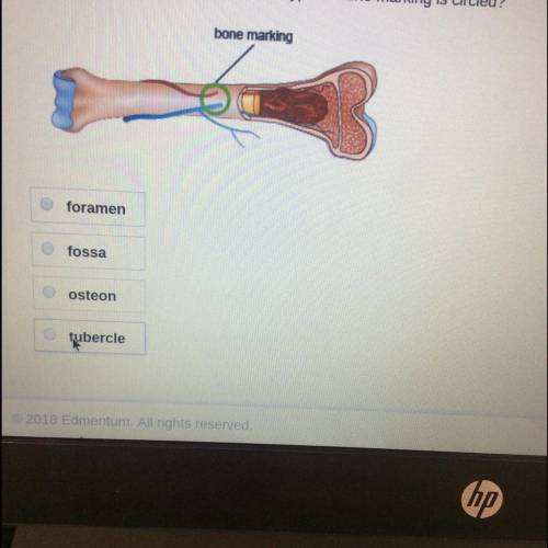 In this diagram of a long bone, which type of bone marking is circled? anatomical drawing of a long