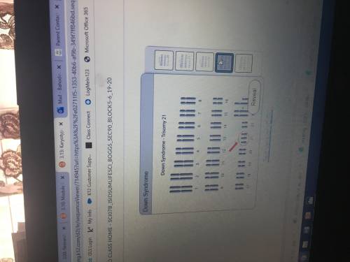 Assignment: Karyotypes Exploration Labeled Diagrams of Karyotype Models Scan the labeled diagrams of