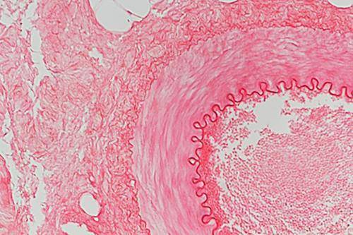 Which statement accurately identifies the order of tissues pictured from left to right in the micros