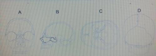 An anatomist needs to cut a skull open with a transverse cut. Which of the diagrams correctly shows