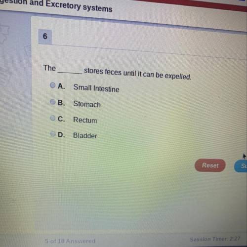 Is it small intestine or Stomach or Rectum or Bladder