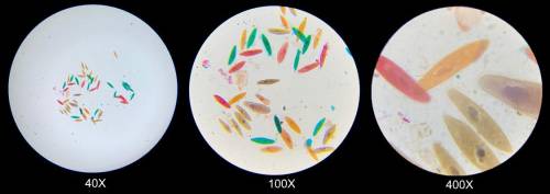 Describe how Stella’s view of these cells and their parts changed as she transitioned through the t