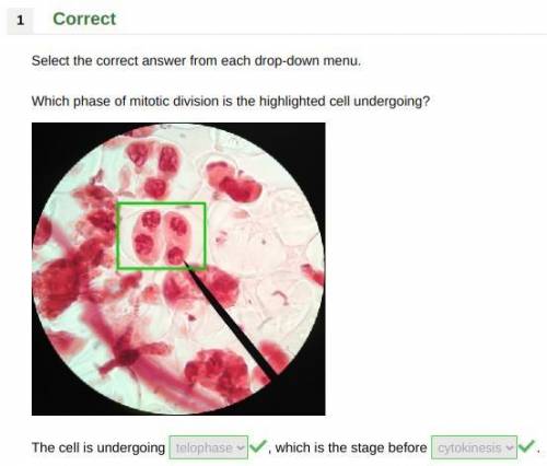 Which phase of mitotic division is the highlighted cell undergoing?

The cell is undergoing ______