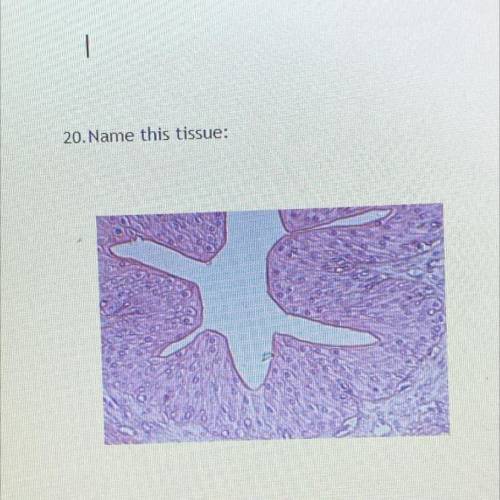 Name this tissue. please help i only have an hour