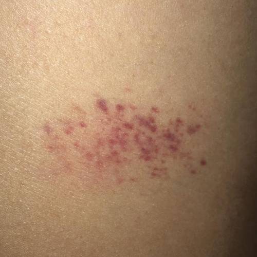 Does any one know what this mark is ?