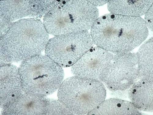 Will award 30 points :))

What stage of mitosis is indicated in the picture below: (Whitefish blas