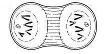 Please help Which diagram illustrates metaphase? A B C D