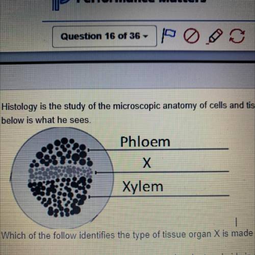 Which of the following identifies the type of tissue organ x made out of an physiological process