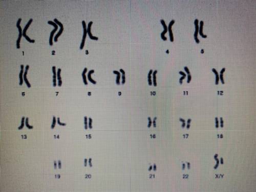 Take a look at the image of a karyotype below. What can you tell from this karyotype?

A. This ind