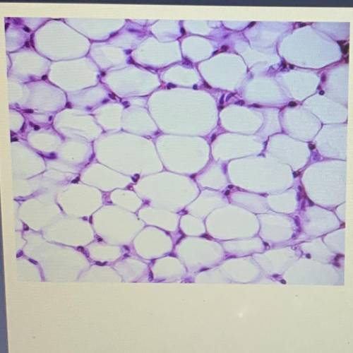 Which level of organization is pictured?
A. cell
B. tissue
C. organ
D. organ system