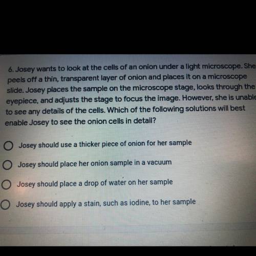 Which of the following solutions will best enable Josey to see the onion cells detail?
