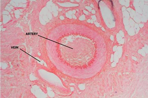 Which statement accurately describes the tissues labeled in the microscopic image?

The muscle tis