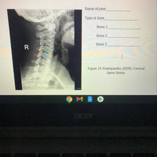 Identify the name of each joint (if applicable) or body structure that appears in the x-rays below.