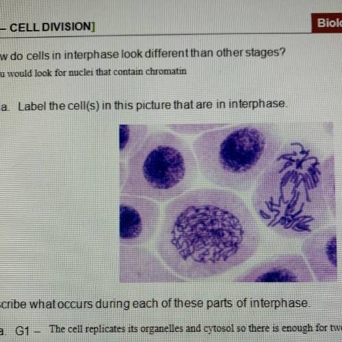 Label the cells in this picture that are in interphase.
