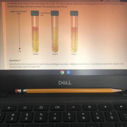 Question 1

Identify the microorganisms in each tube as obligate aerobes, obligate anaerobes, or f