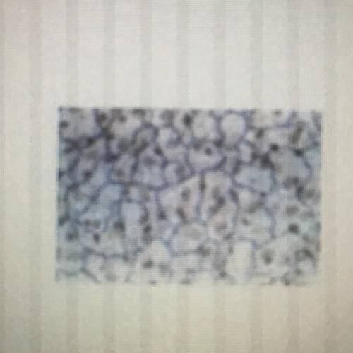 Fill in the Blank: The picture to the right shows you

many skin cells working together to form ep