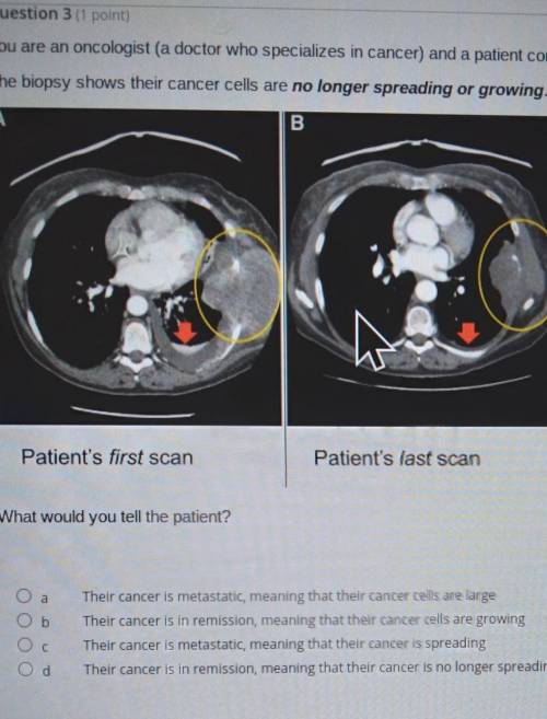 What would you tell the patient? ​
