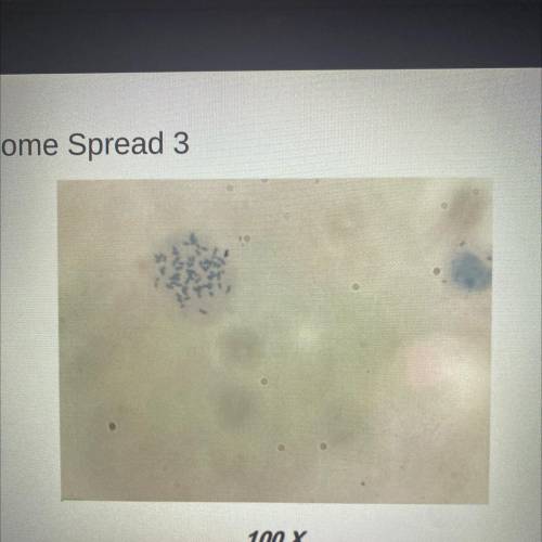 Describe what the chromosome look like to you in this chromosome spread.