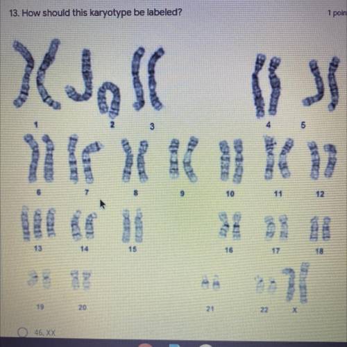 Can someone help me with this question? the options are..

A. 46, XX
B. 46, XX 
47, XY, +21
47, XX