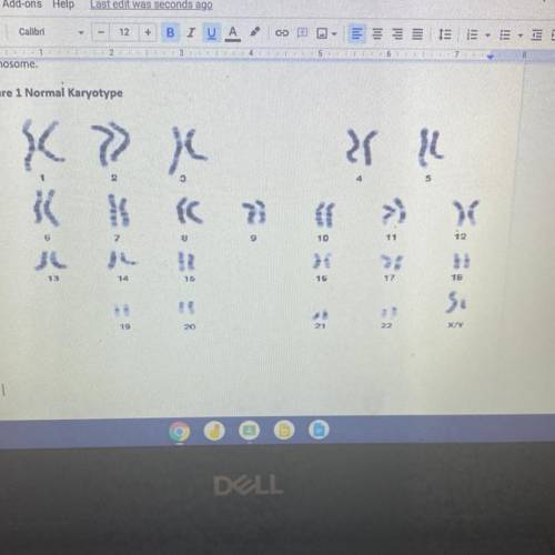 How many autosomes in figure 1 ?

How many sex chromosomes are in figure1 ?
What is the name of th