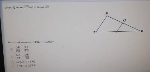 Which condition proves PRT ~ QRS​