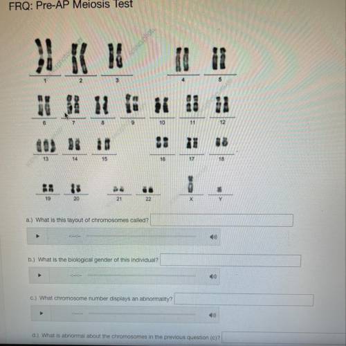 A) what is this layout of chromosomes called?

b) what is the biological gender of this individual