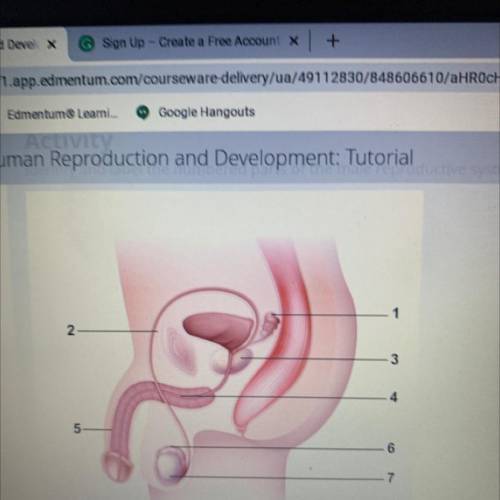 Identity and label the numbered parts of the male reproductive system in the diagram