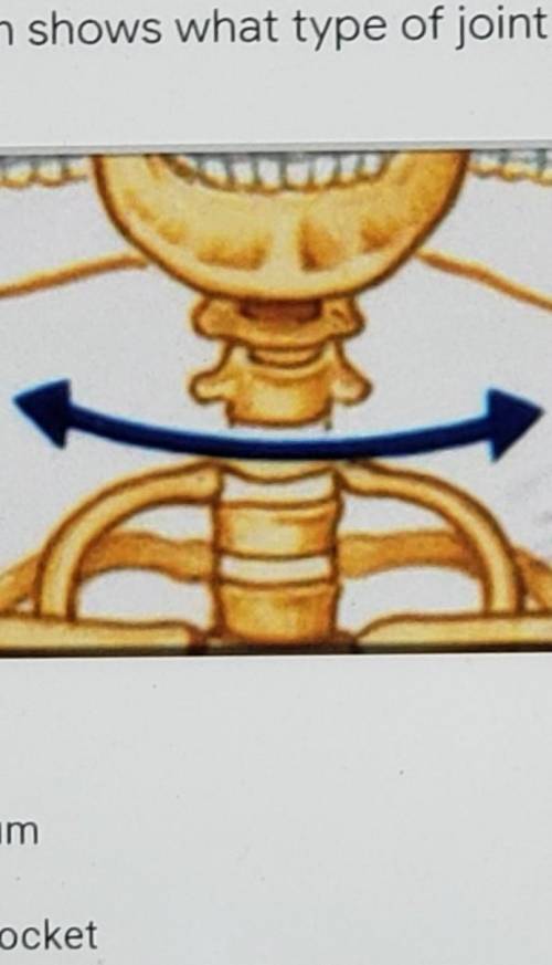 The diagram shows what type of joint ​