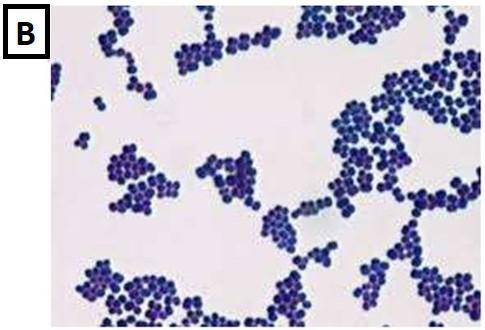 Microbiology - The GRAM stain method was applied on both pictures. What is the result found on each