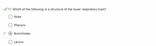 Which of the following is a structure of the lower respiratory tract?