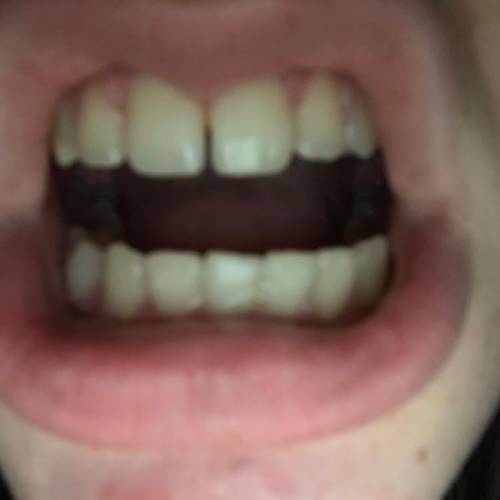 Do my teeth look straight? 
answer asap